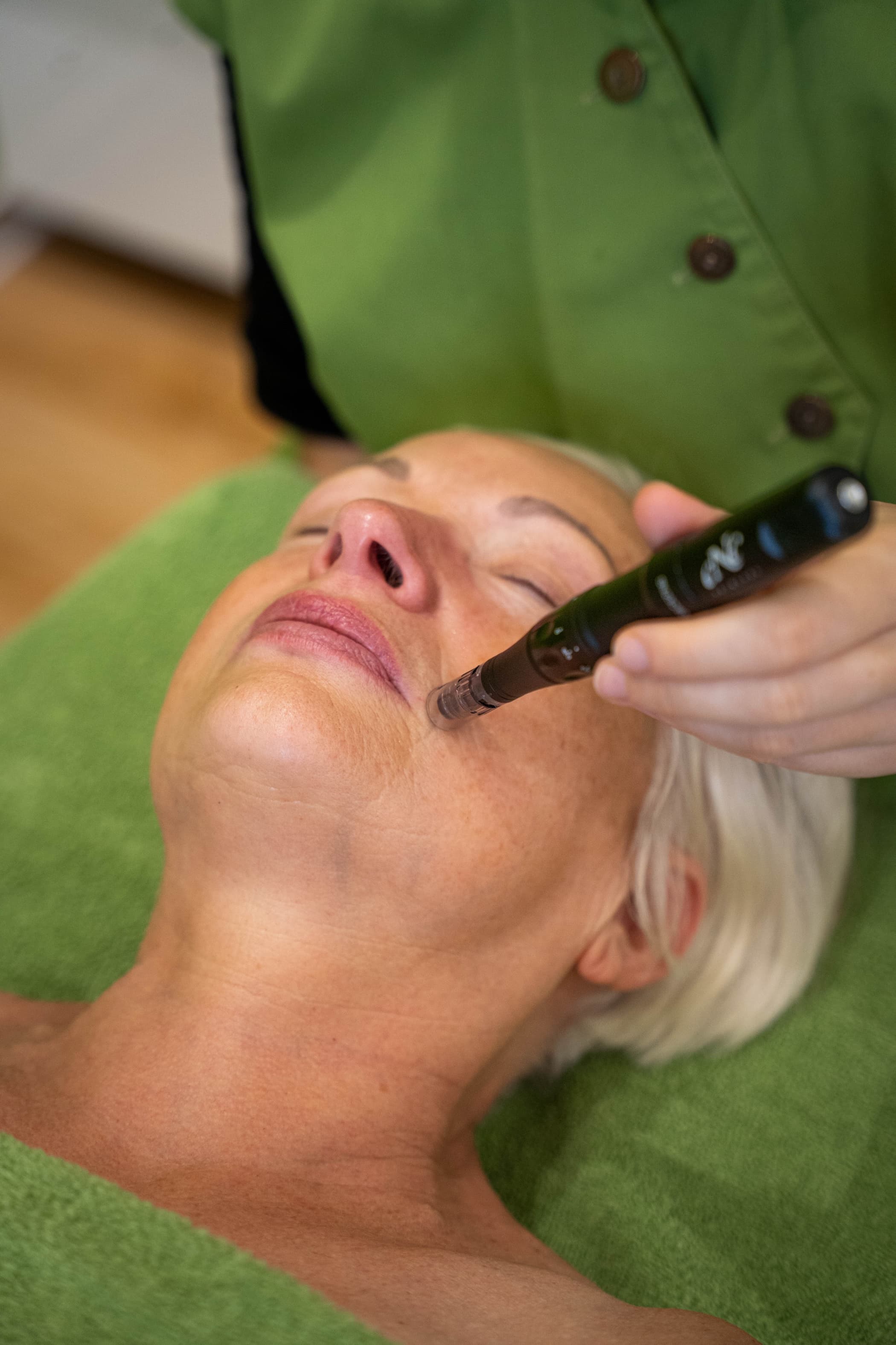 Microneedling-Behandlung fürs Gesicht